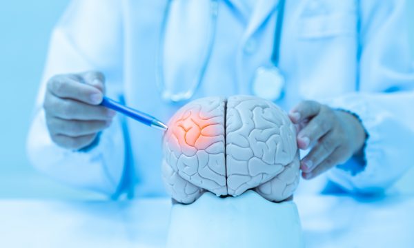 Neurologist hand pointing brain anatomy human model and brain disease lesion on white background.Part of human body model with organ system for health student study in university.Medical education.